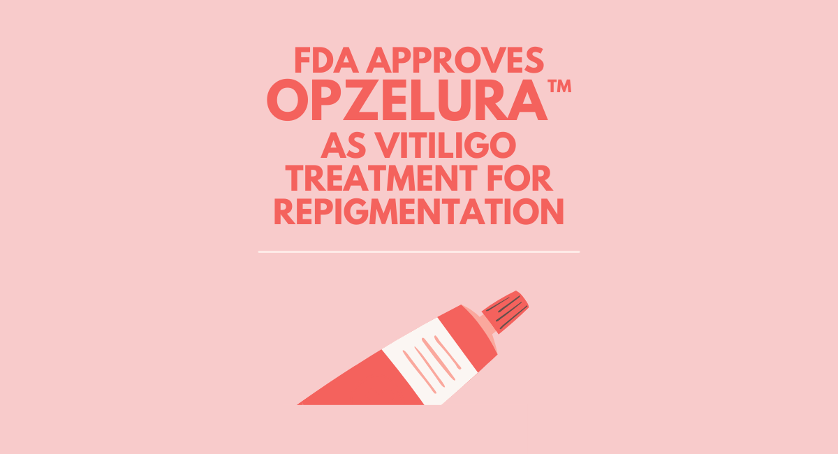 FDA Approves First Vitiligo Treatment for Repigmentation