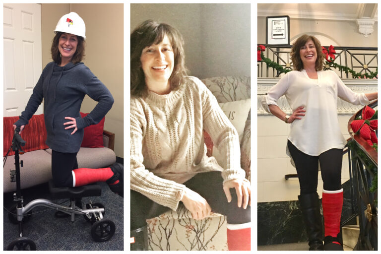 Leg Cast Fashion Tips Living in Normal