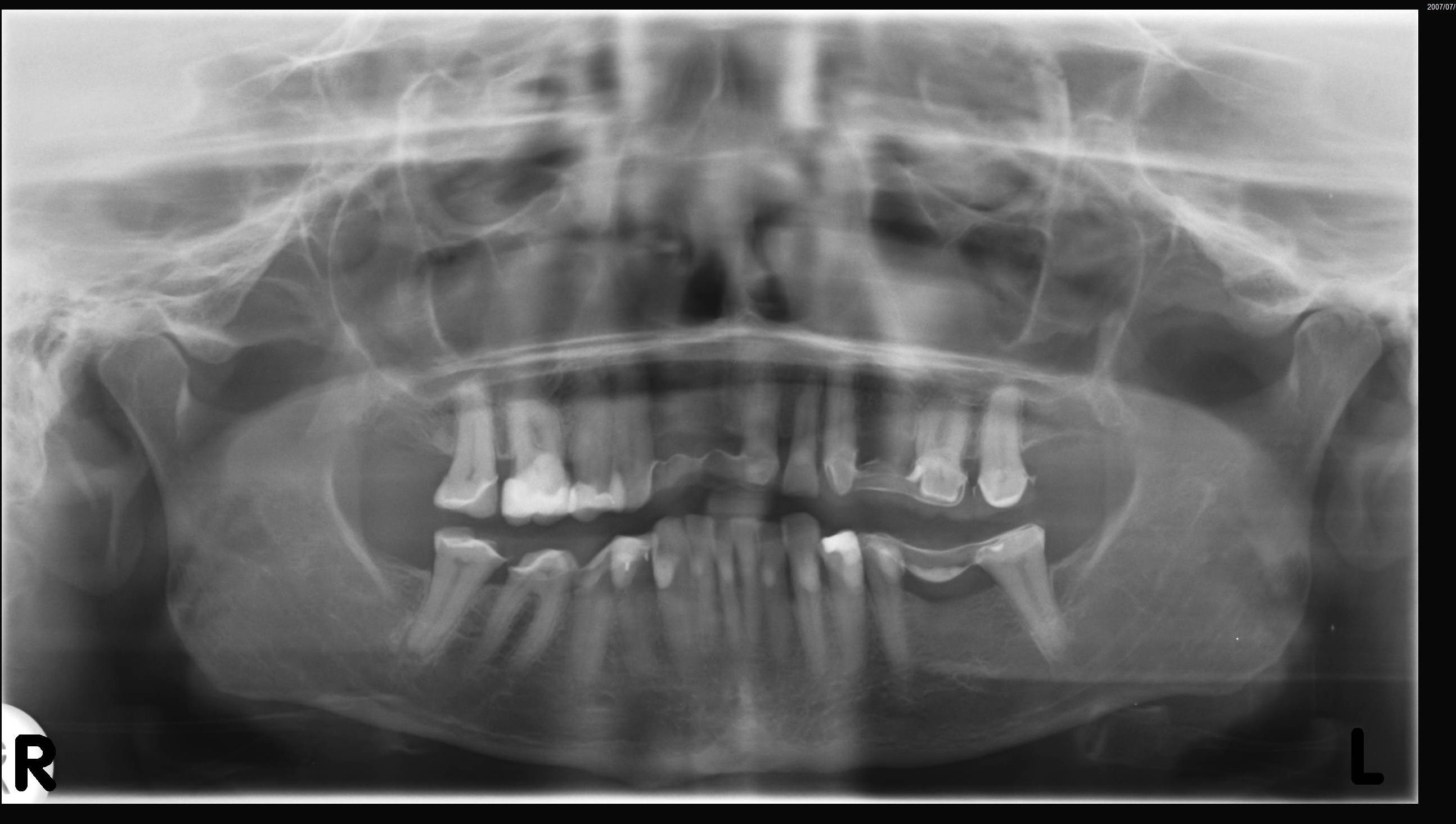 PAN’s & Cavitat scans Living Supplements