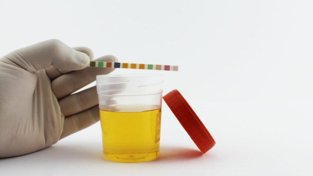 Delta 8 Urine Testing How Long Does Delta 8 Stay In Your Urine Reddit