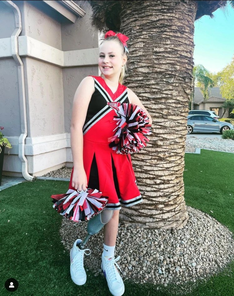 Best Amputee Halloween Costumes 2022 Amplitude