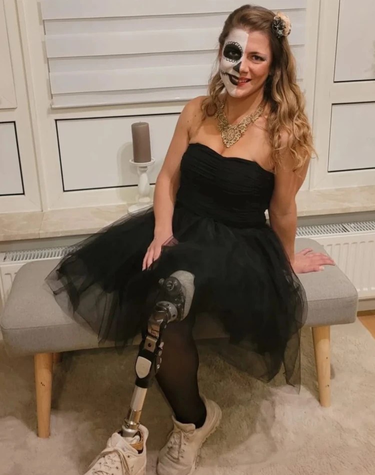 Best Amputee Halloween Costumes 2022 Amplitude
