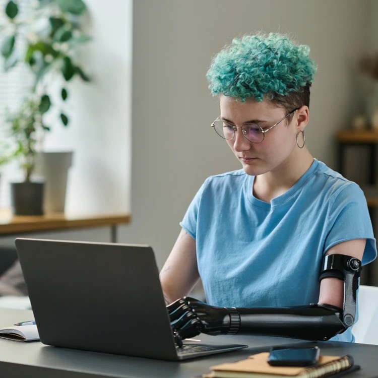 How to Be an Amputee With a Job Amplitude Magazine