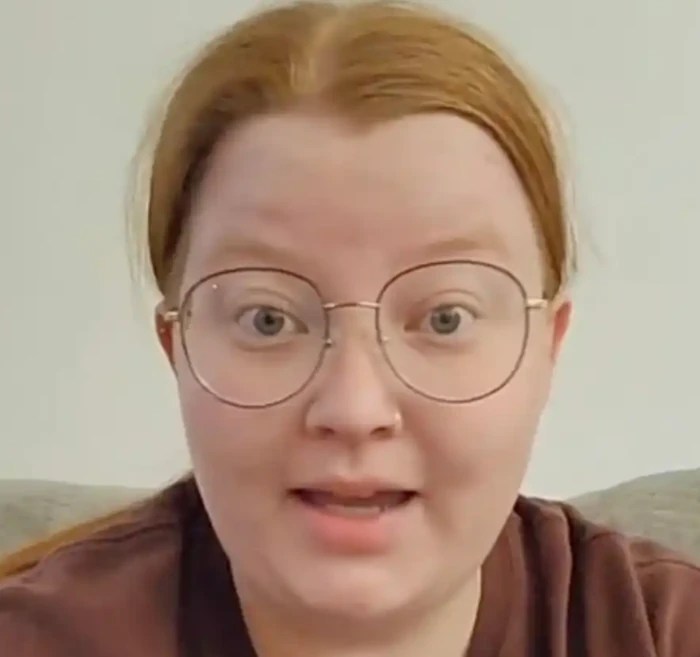 Anatomy of an Amputee's Viral TikTok Amplitude