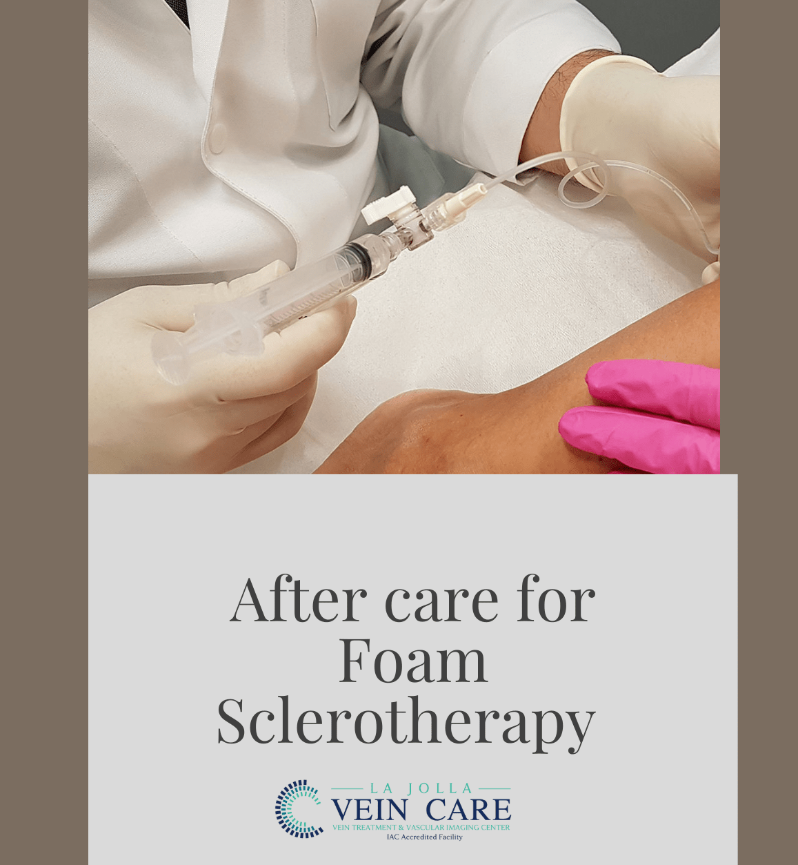 Foam Sclerotherapy