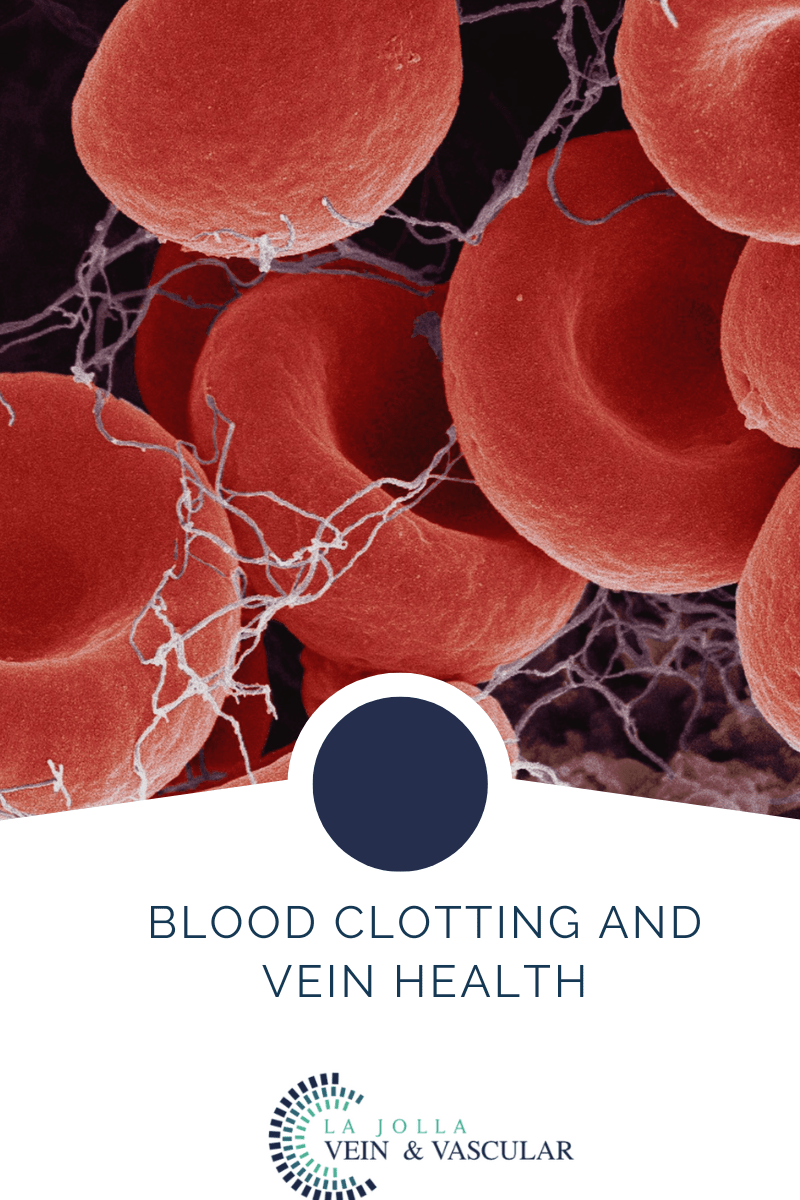 Vein & Vascular Treatment Vein and Vascular Care Clinic La Jolla, CA