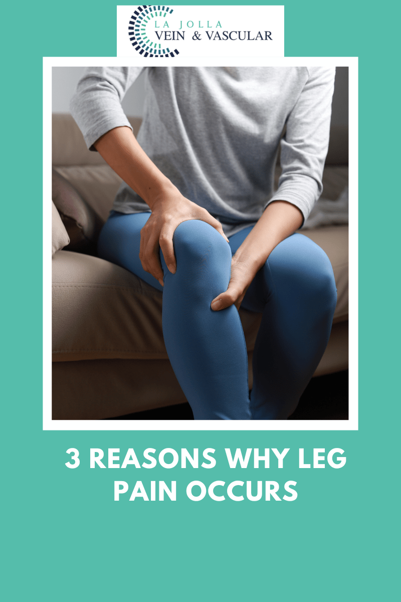 Vein & Vascular Treatment