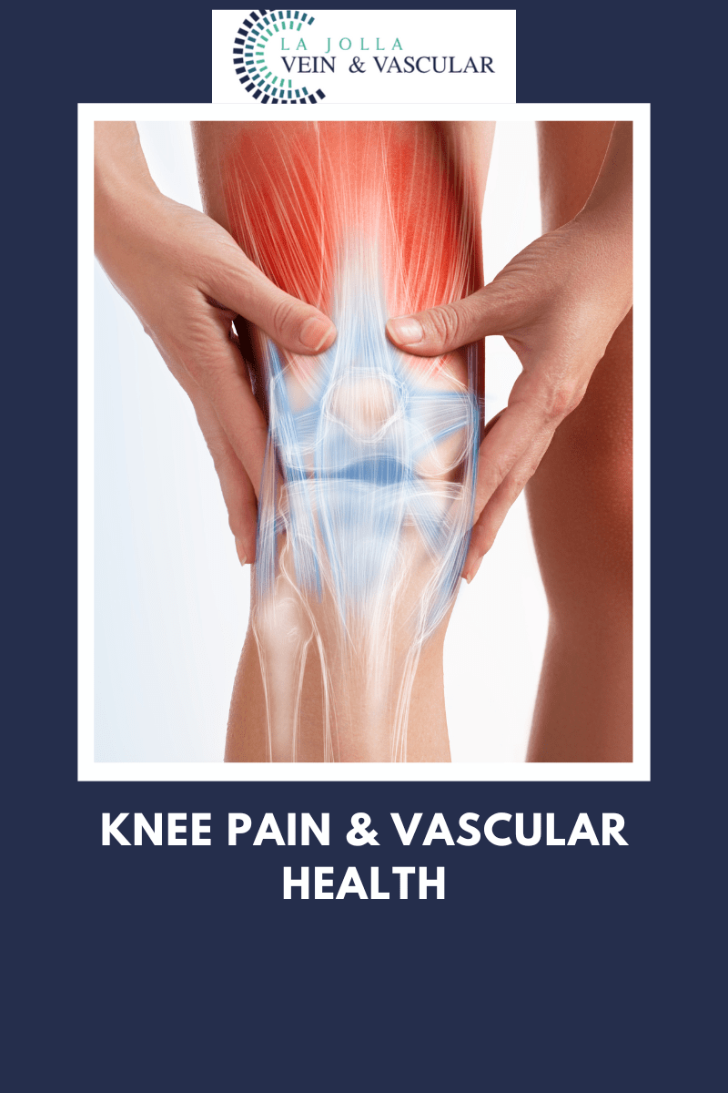 Vein & Vascular Treatment Osteoarthritis and Knee Pain