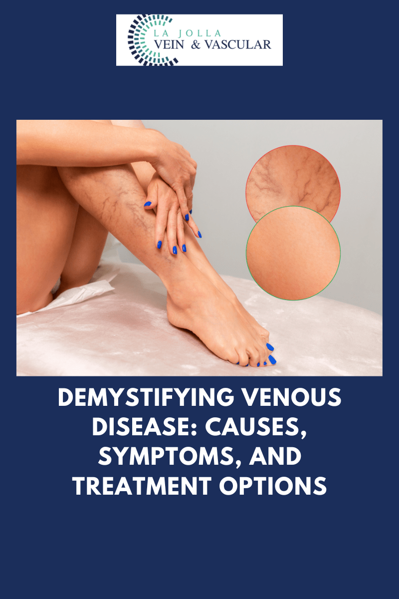Vein & Vascular Treatment Venous Disease