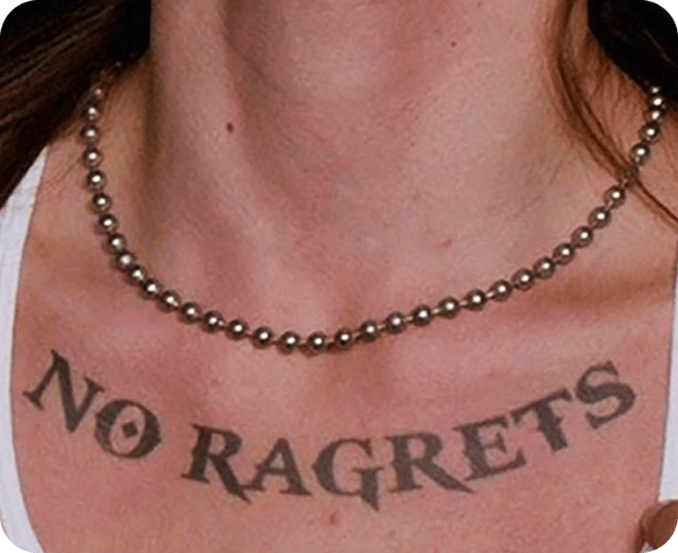 tatoosremoval Leicester Laser Clinic