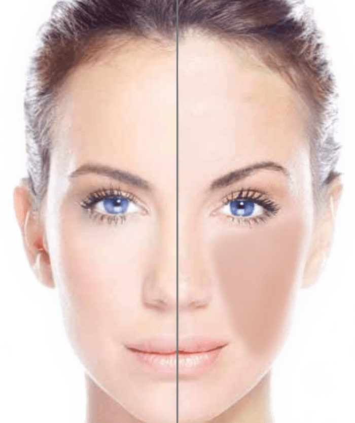 Treatments Leicester Laser Clinic