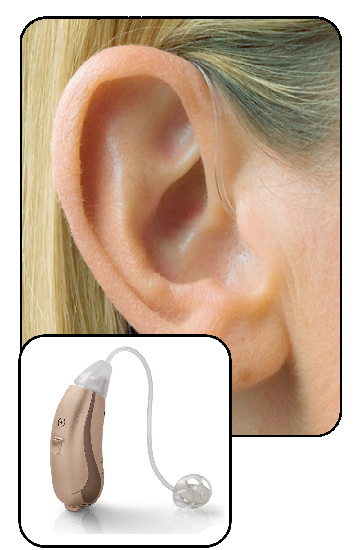 Joy Mini BTE Hearing Aids For Sale!