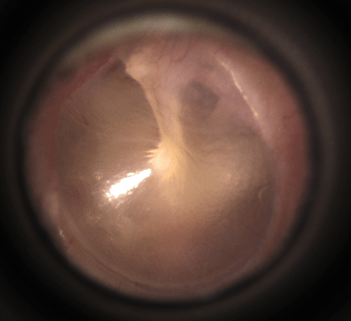 Normal TM Louis Hofmeyr