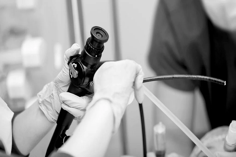 Exploring Endoscopes A Simple Guide to Understanding Their Uses and