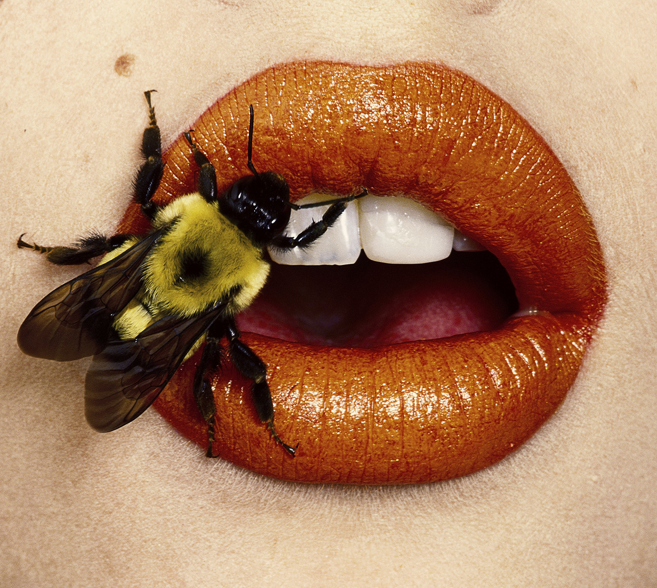 Bee Stung Lips History