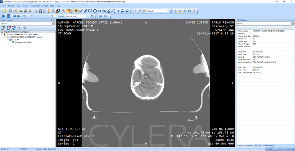 Gaining XRay Vision Preventing healthcare cyberattacks via files with LogRhythm LogRhythm