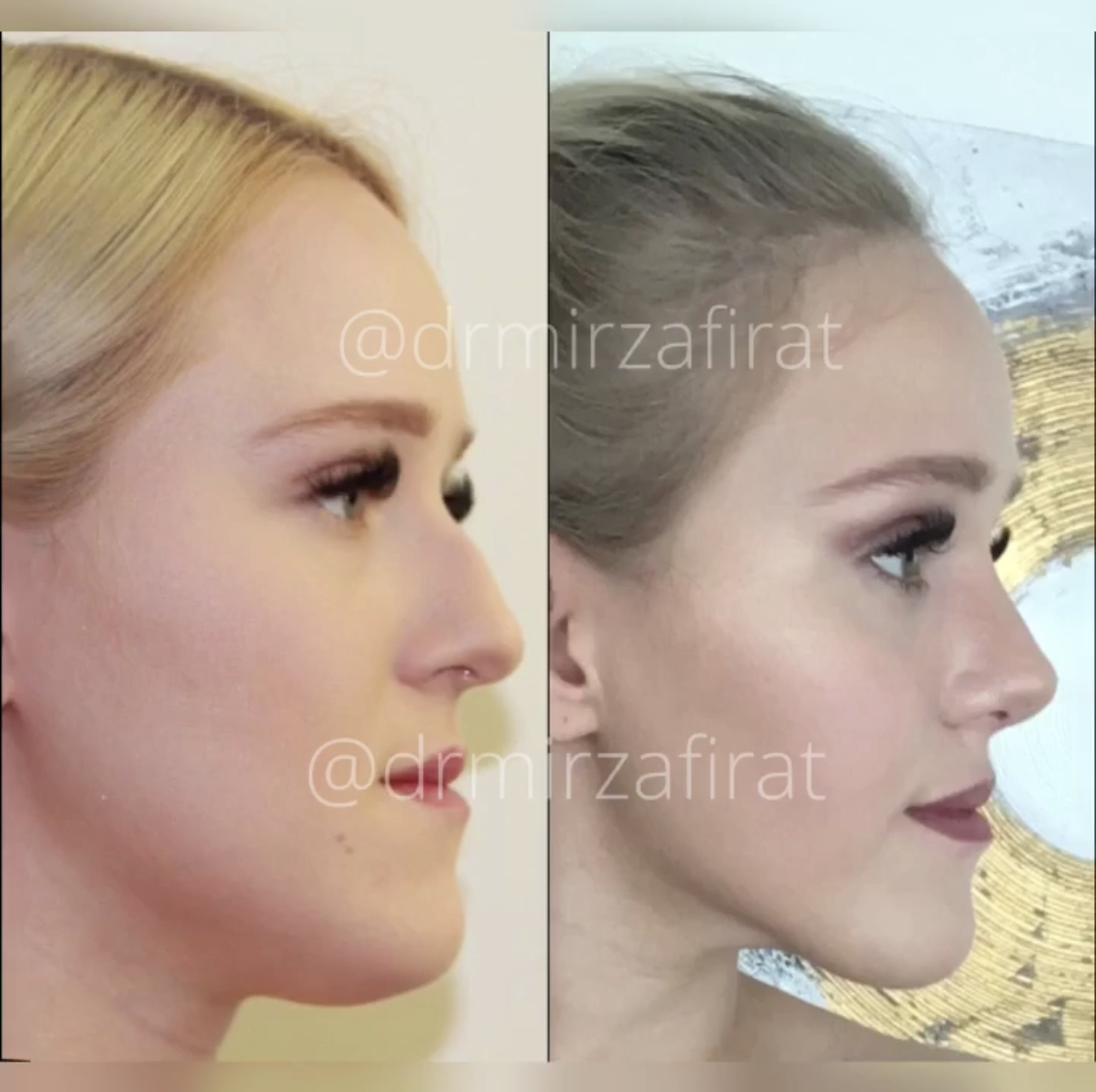 /g/ How to cope with being ugly