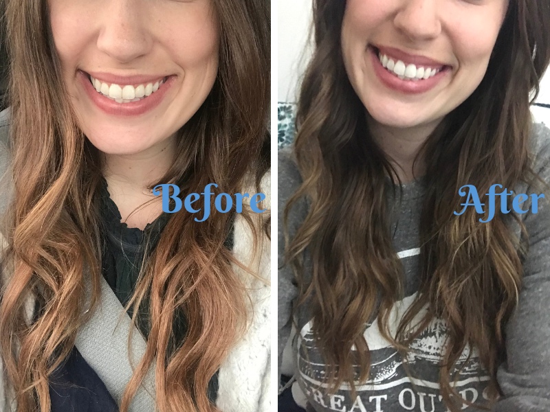 Crest Teeth Whitening Strips Before And After