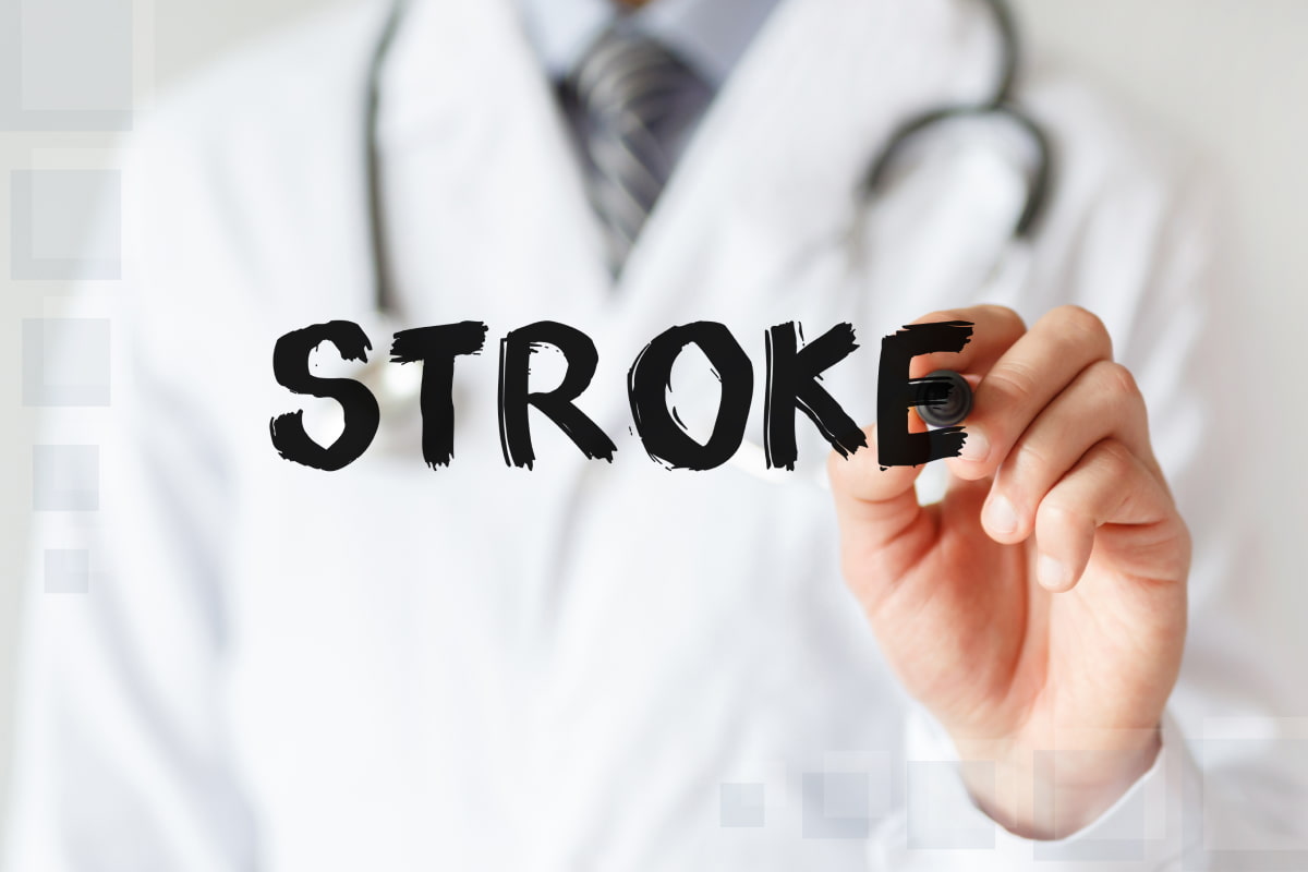 Testing and Diagnostics for Stroke Lone Star Neurology