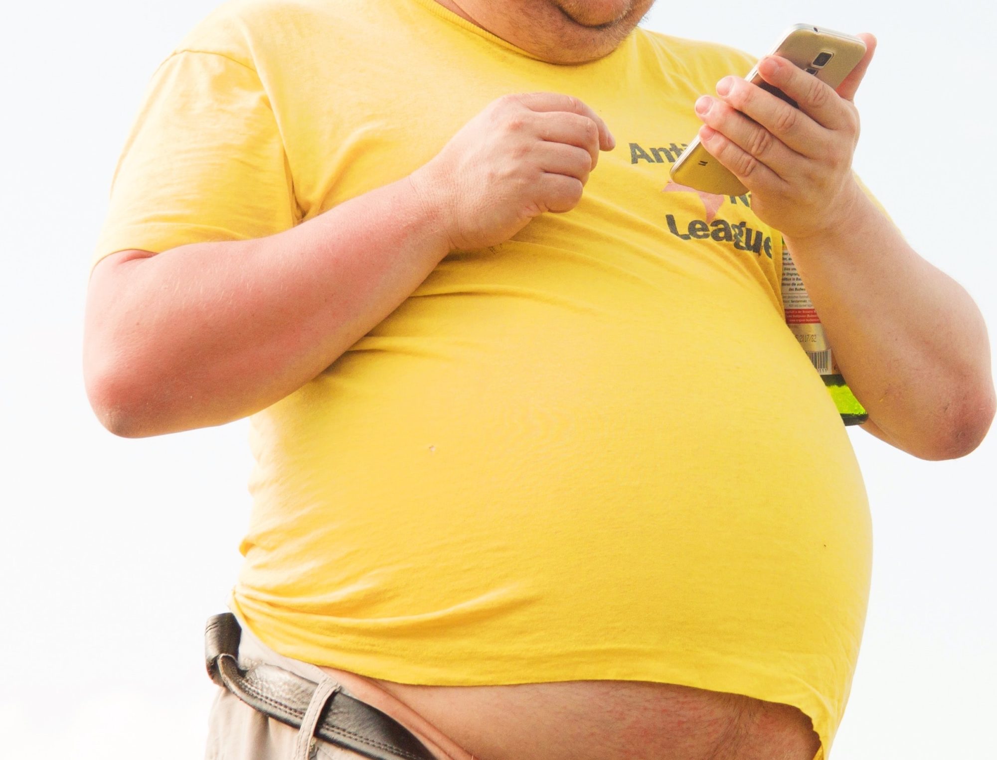 Obesity Treatment is Complex and Requires Compassion Longevity LIVE