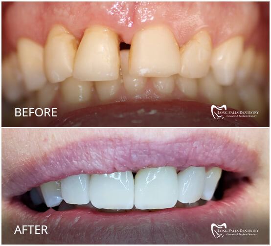 Long Falls Dentistry Carthage Dentist Dr. Zeeshan Salam