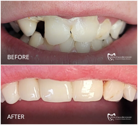 Long Falls Dentistry Carthage Dentist Dr. Zeeshan Salam