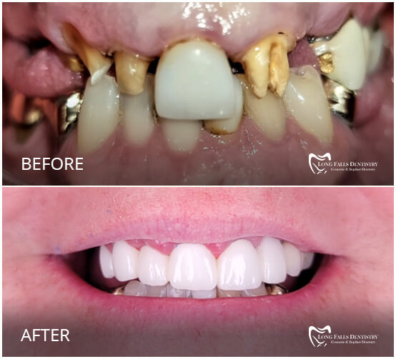 Long Falls Dentistry Carthage Dentist Dr. Zeeshan Salam