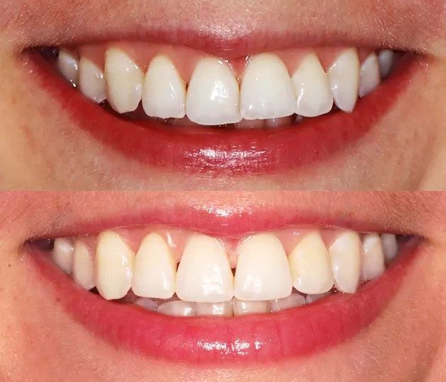 Restorative Dentistry Transforming Smiles & Oral Health