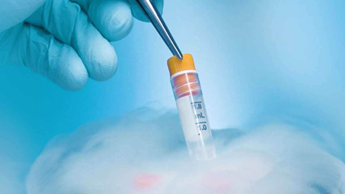 When to Consider Sperm Freezing Loop21