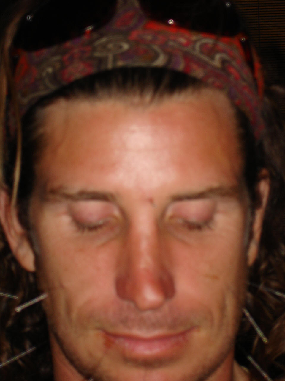 Community Acupuncture of Honolulu Hawaii, Acupuncture Hawaii