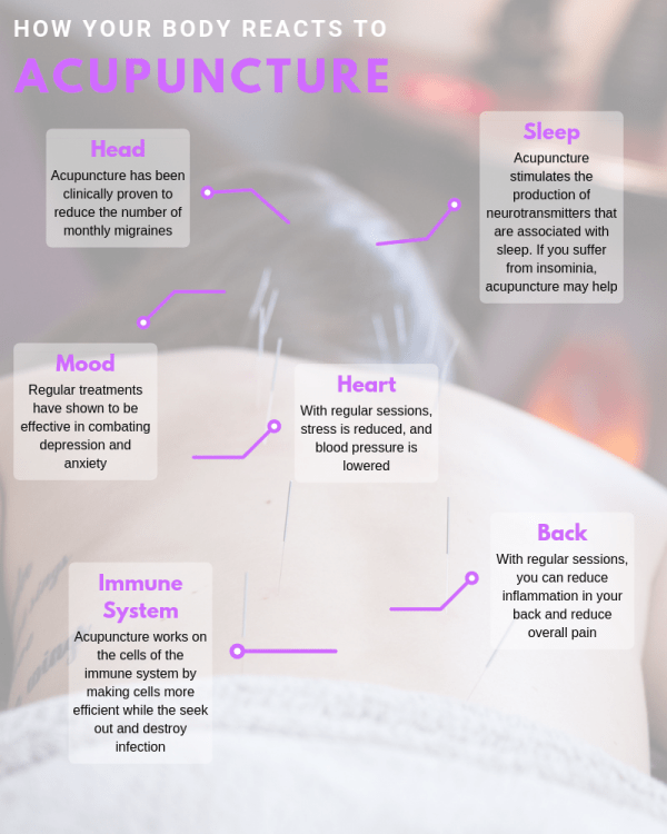 Best Acupuncture in Wheat Ridge Acupuncturist Denver Lotus Studio