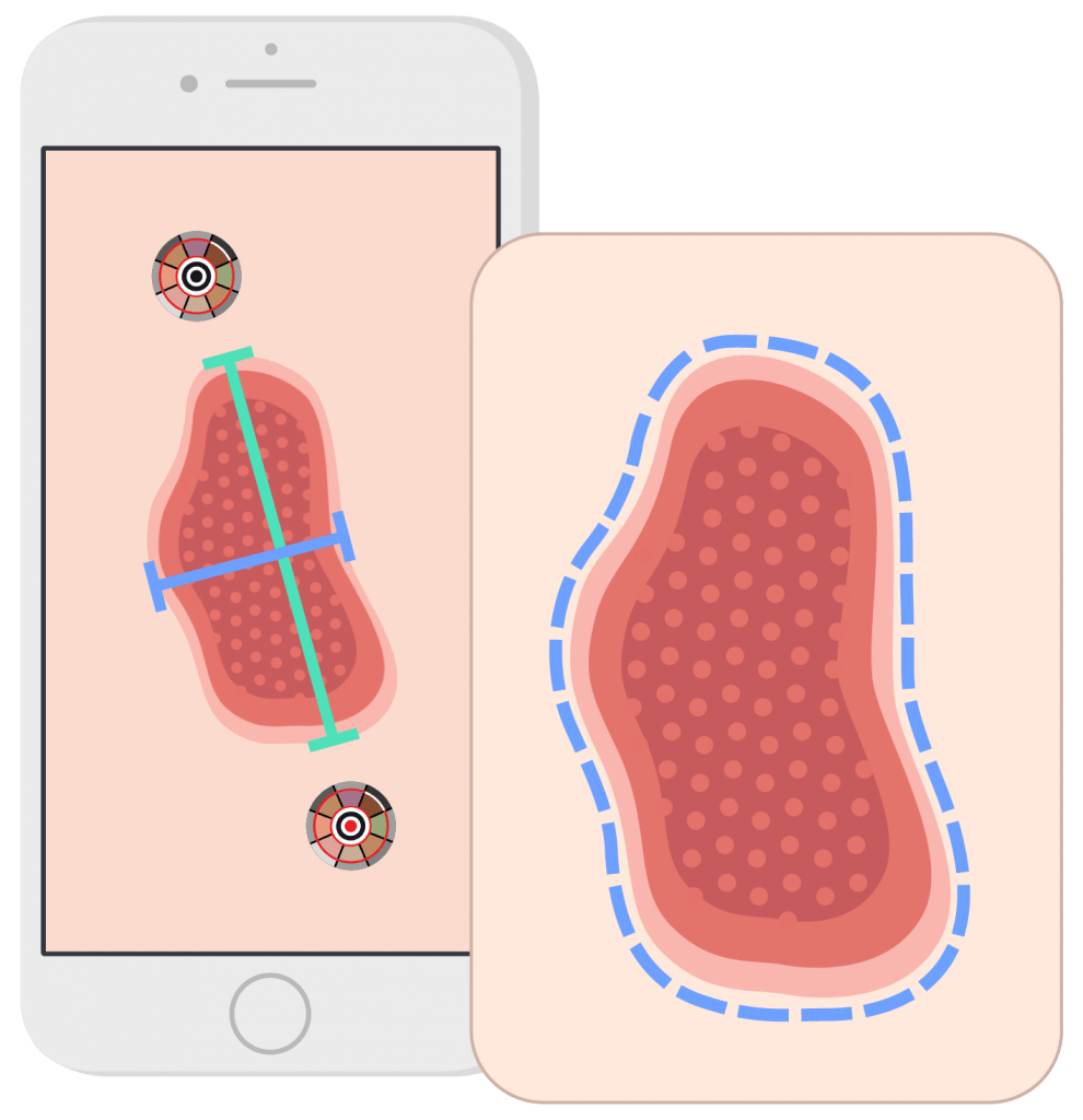Digital Wound Management US Healthy