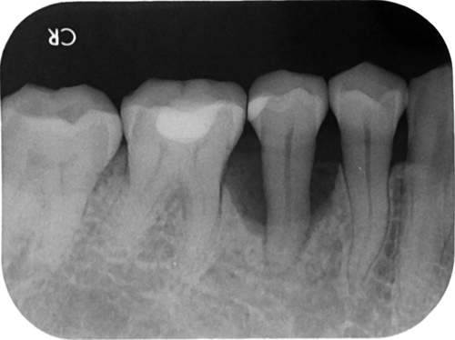 從一顆病牙談起