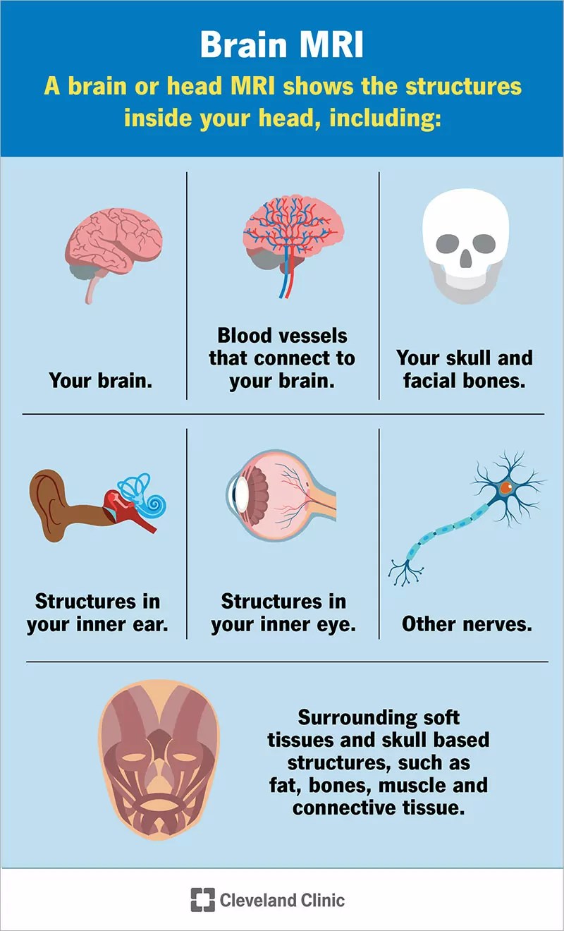Smegenų MRT Kas Tai Yra, Tikslas, Procedūra Ir Rezultatai SFOMC