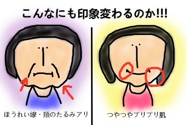 笑いじわ | 足立区北千住の美容鍼「北千住らっく鍼灸治療院」口コミで人気！ 簡単ヨガ】笑いじわと頬のたるみを撃退！簡単「顔ヨガ」にチャレンジしてみよう | Luchta