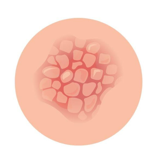 High Quality & Precise Fungal Culture, Body fluid Near Me Lucid