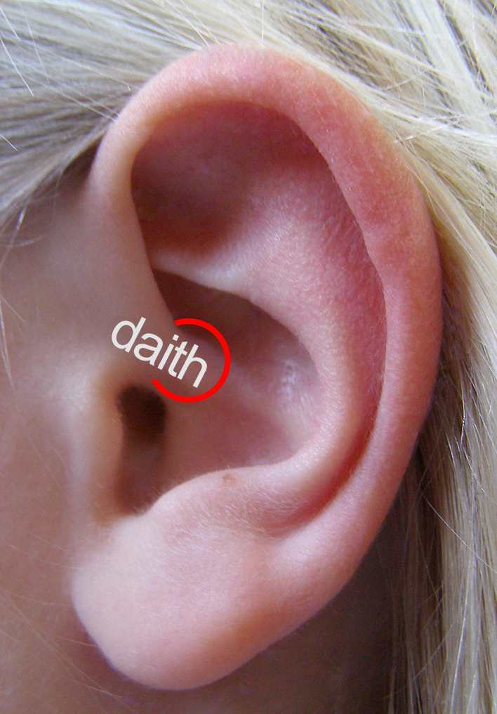 Migraine and Headache Relief with a Daith Piercing