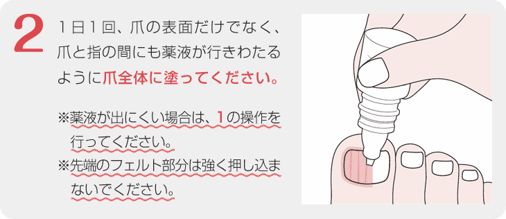 爪白癬治療剤 ルコナック 爪外用液5 ルリコナゾール外用液 塗布方法