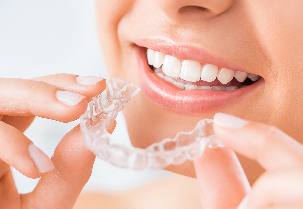 Clear Braces Cost Invisalign Dental Treatment in Singapore