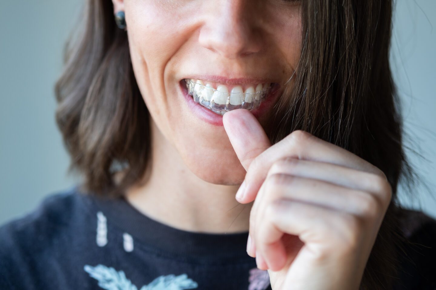 Leading NJ Orthodontist Transform Your Smile with Invisalign