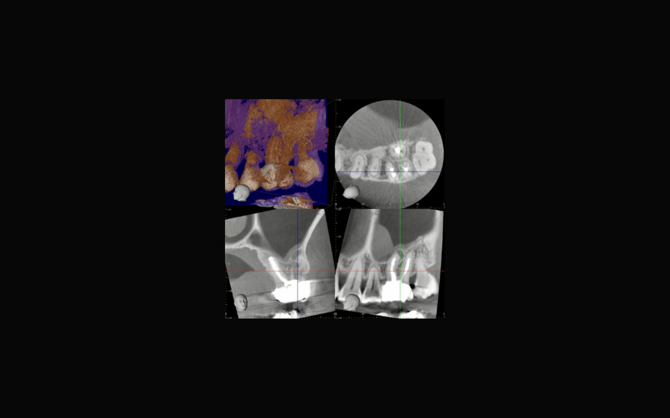 Lehigh Valley Endodontics Bethlehem Root Canal Dental Office in