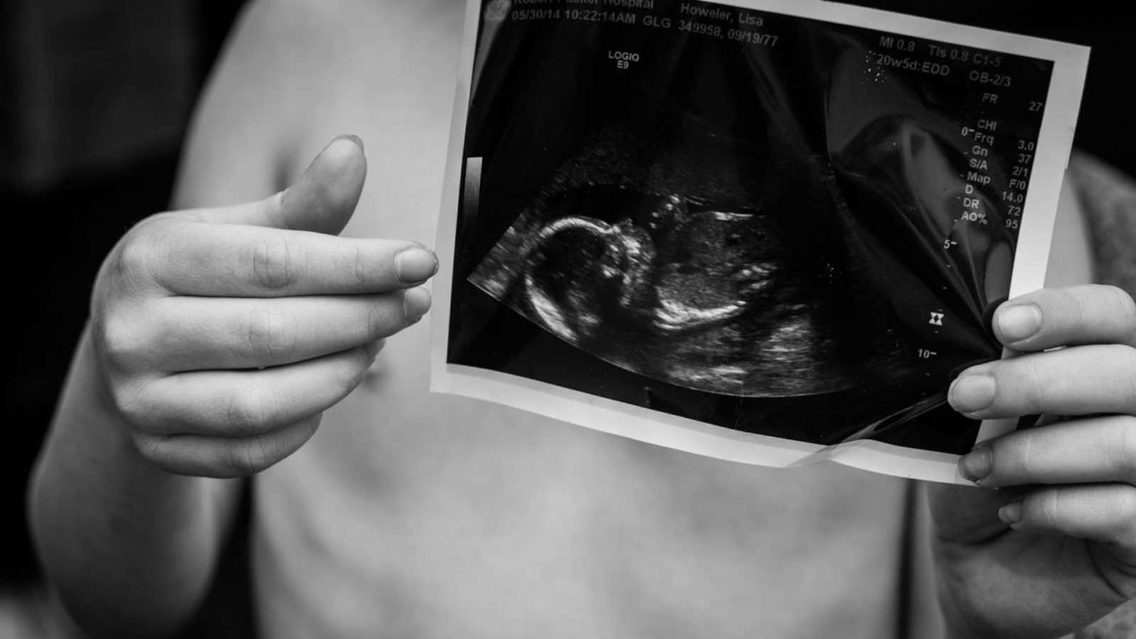‘It was two days after the ultrasound when my body spontaneously began