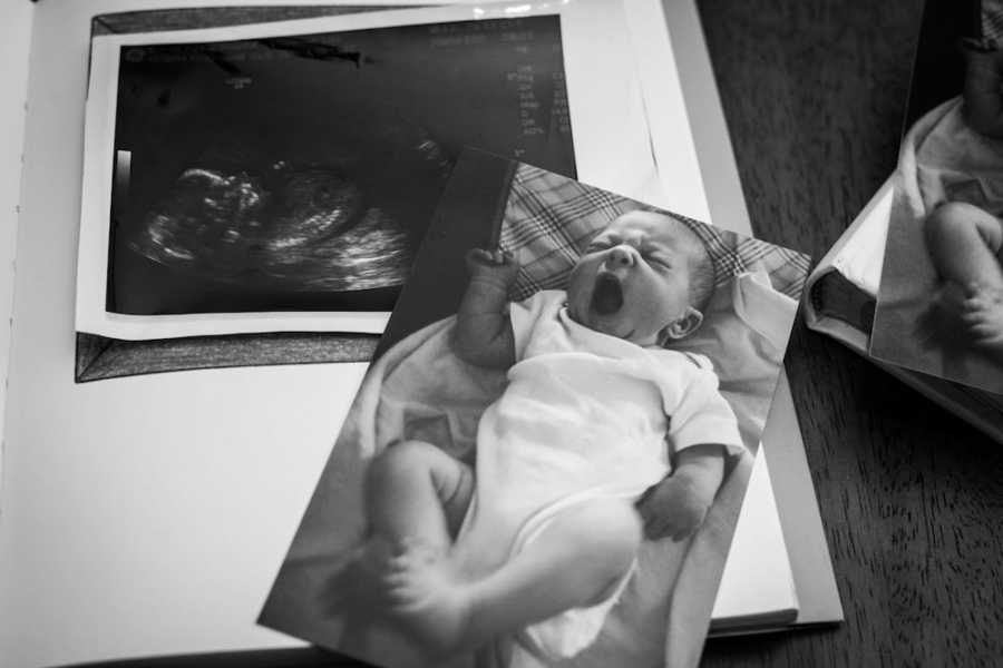 ‘It was two days after the ultrasound when my body spontaneously began
