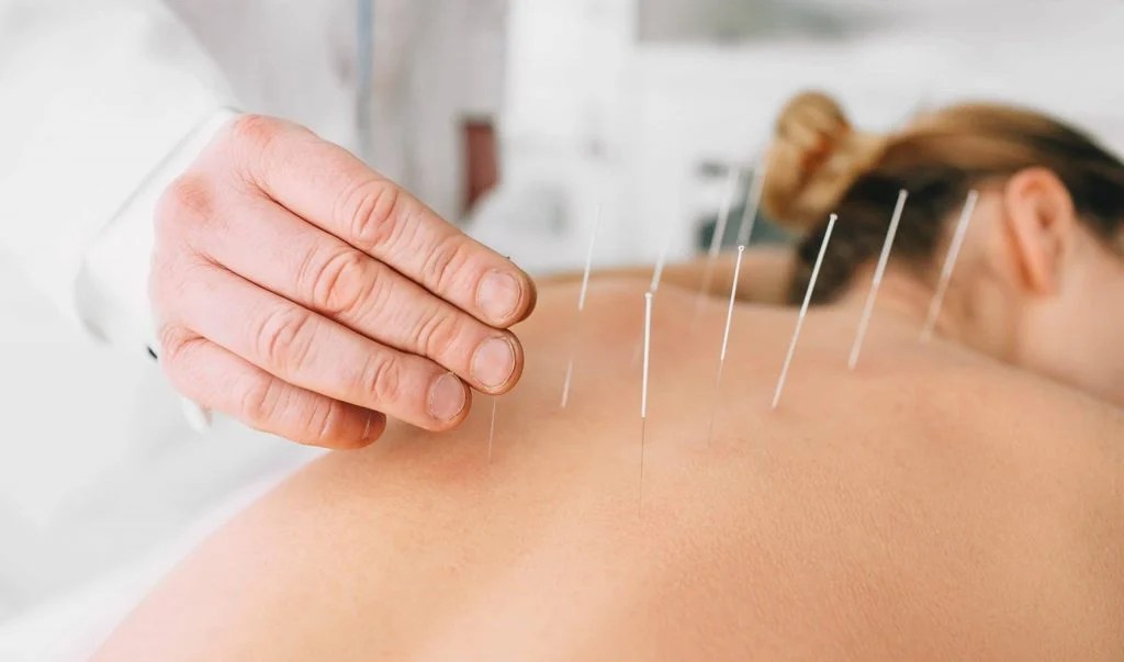 Does Acupuncture Cause Bleeding? Orthopedics & Sports Acupuncture