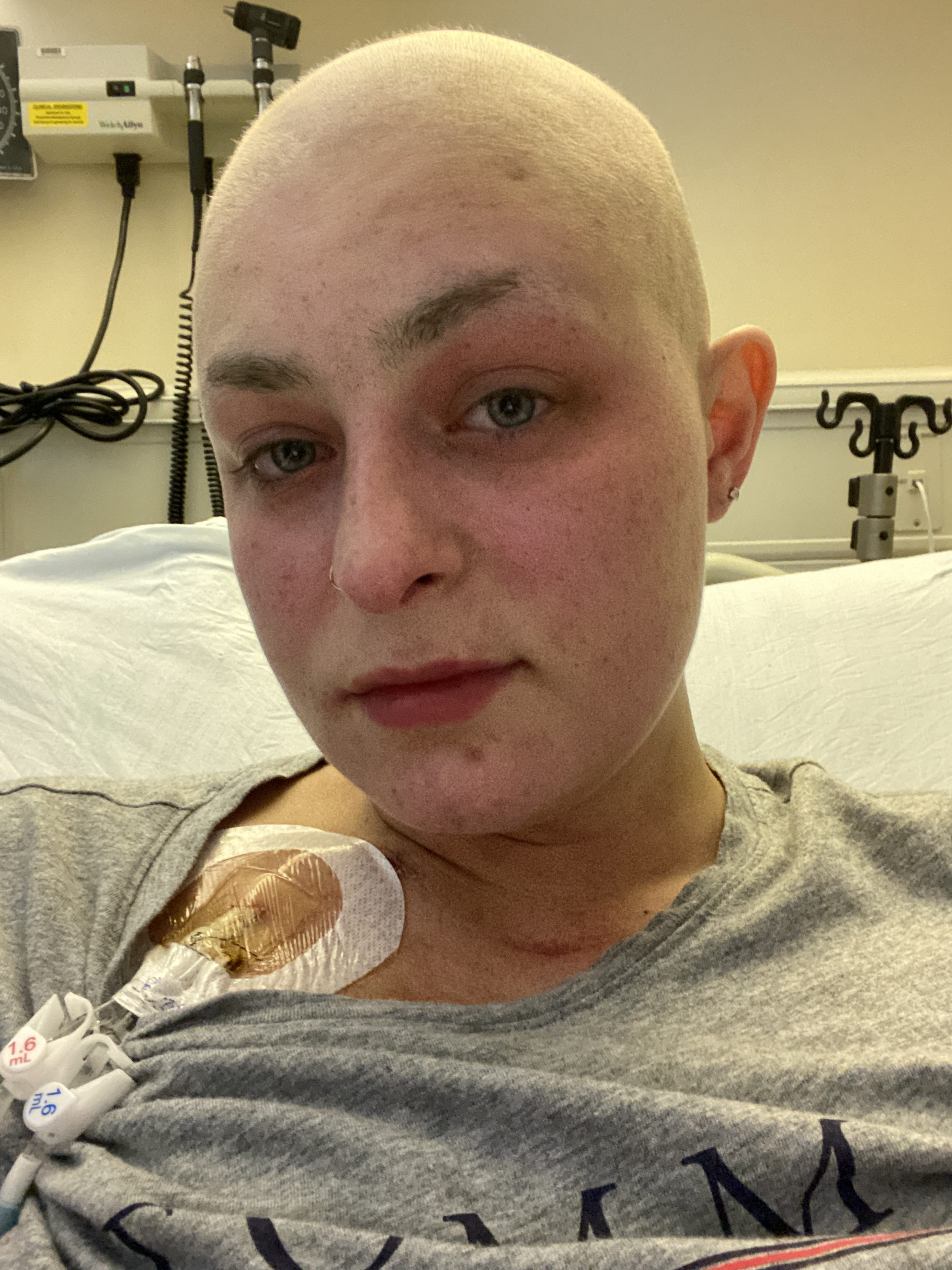 Hannah's Hodgkins Lymphoma Story Lymphoma Out Loud
