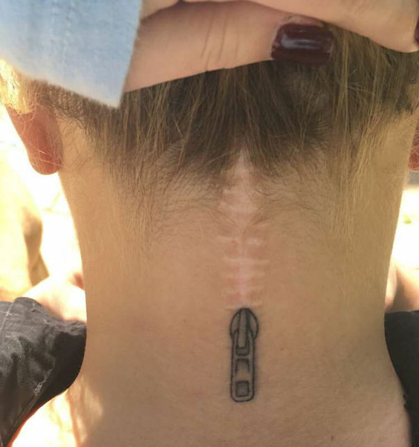 25+ Amazing Tattoos That Transform Body Scars Into Art 646_x_605_jpg