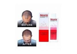Nizoral Shampoo 120 ml x Four Bottles in TN4 Wells für 35,00 £ zum