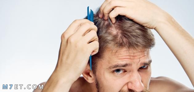 كيفية الحفاظ على الشعر للرجال