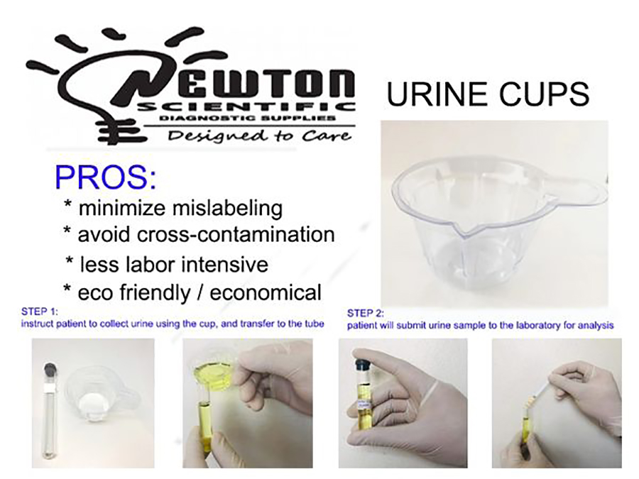 Urine Cups Macromed Philippines