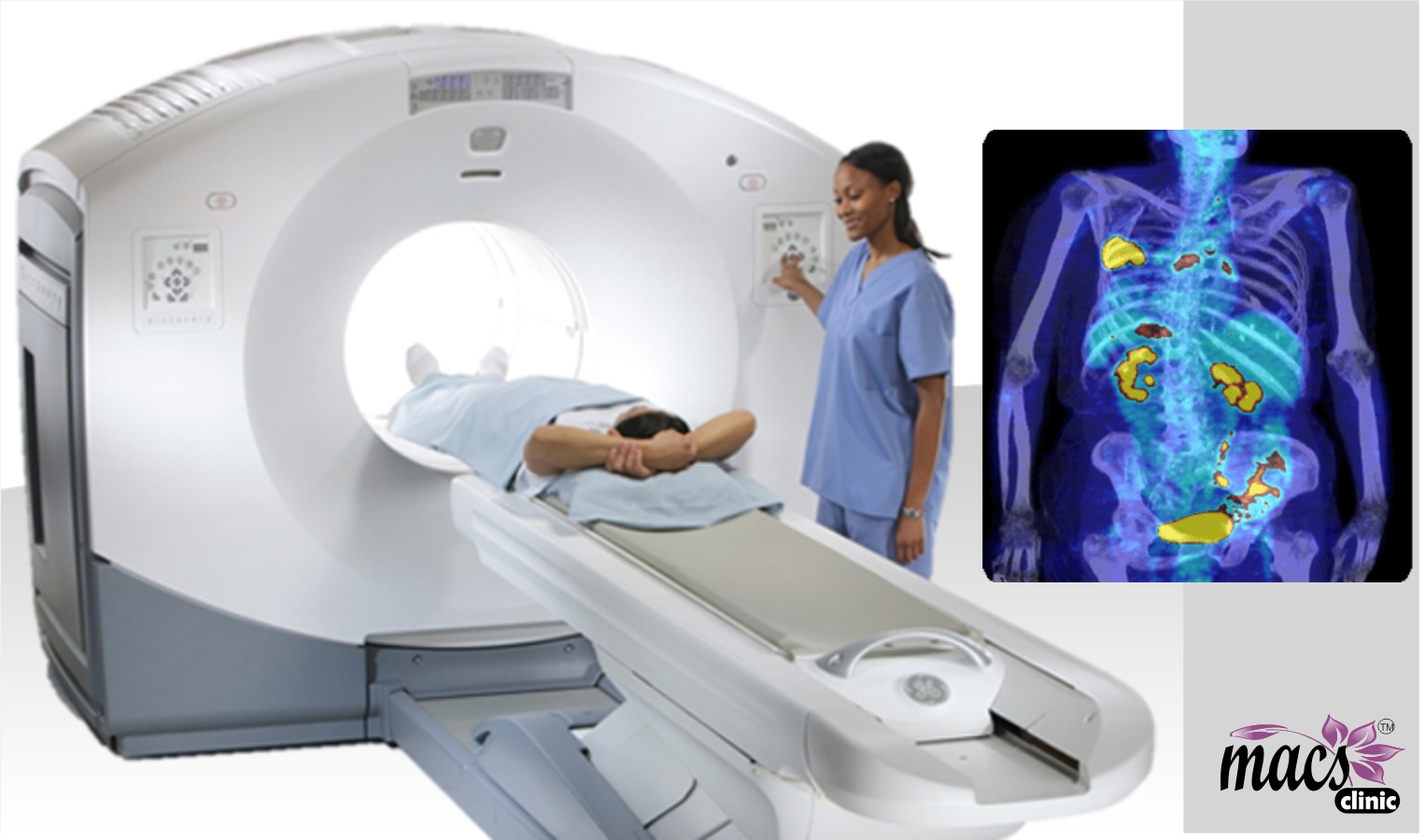 Quintessential PET scan does not detect cancer cells. Macs Blogs